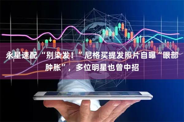 永星速配 “别染发!”尼格买提发照片自曝“眼部肿胀”,多位明星也曾中招